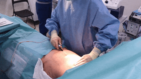 8aa14ed86e0f7788c878cccc15030d83.gif